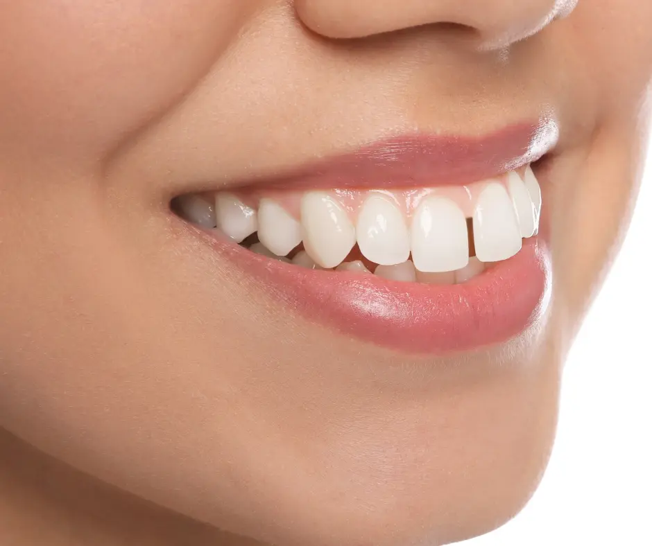 Front Teeth