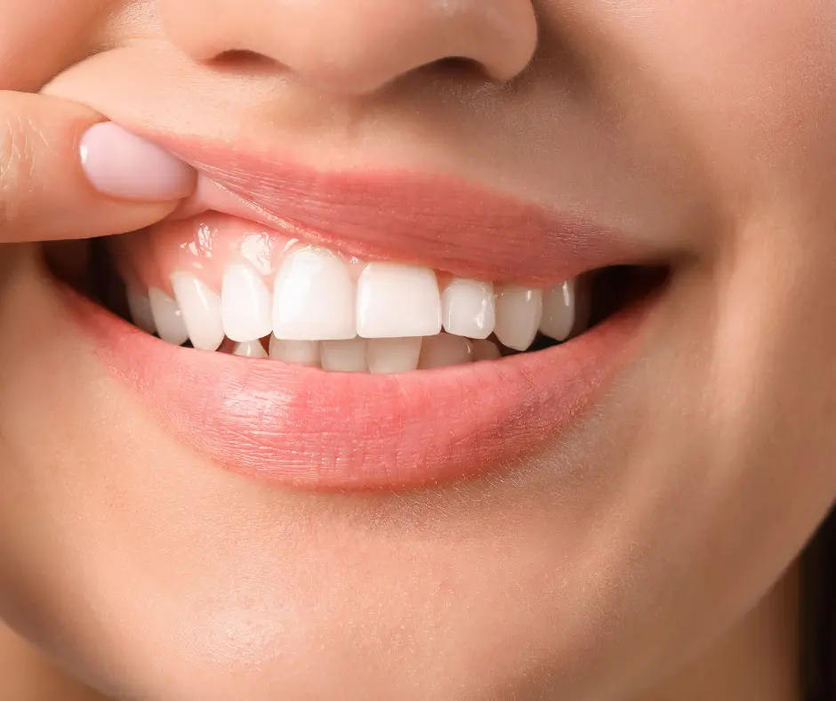 healthy-Teeth