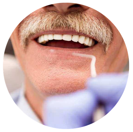 Dental cleaning procedure close-up