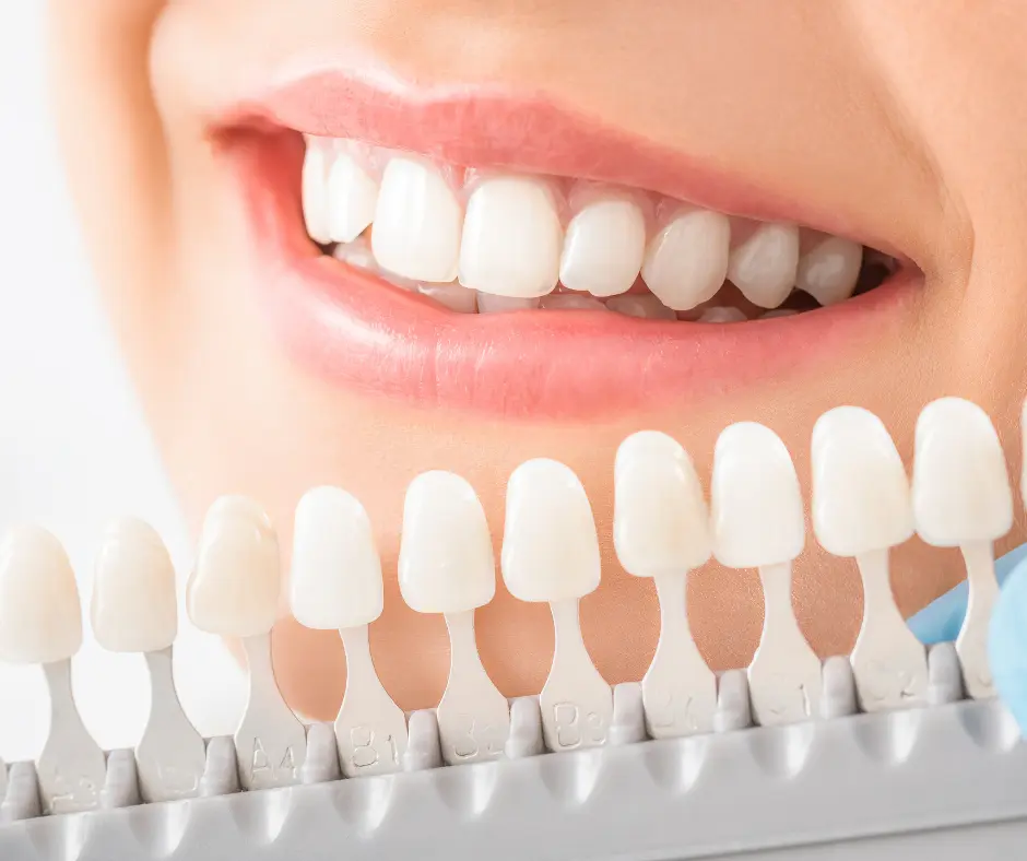 Teeth shade guide comparison in Wethersfield CT