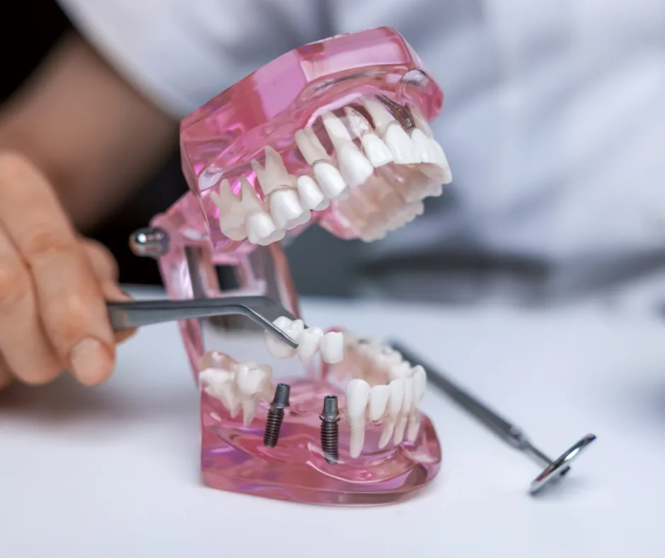 Denture model cleaning dental care
