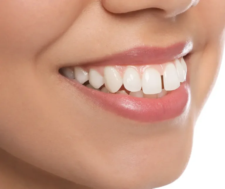 Front teeth- in Wethersfield CT