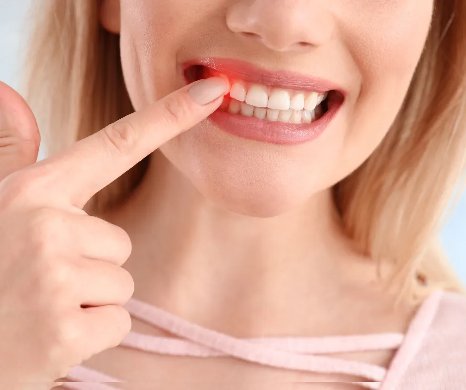 Are You Experiencing Symptoms of Gum Disease?
