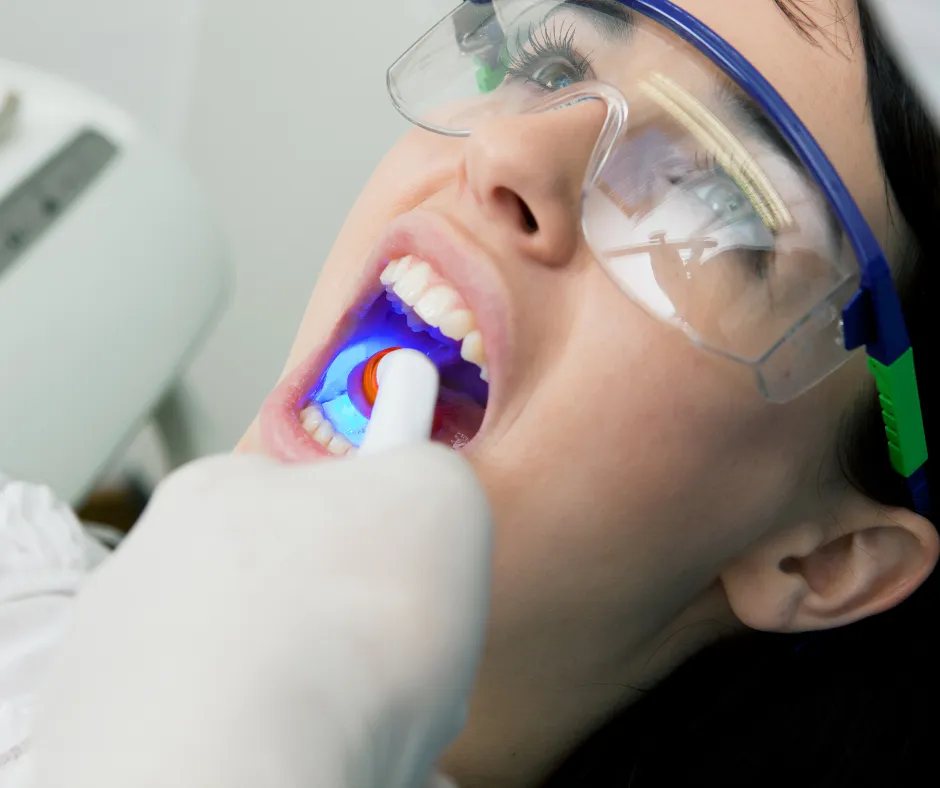 UV light teeth whitening procedure
