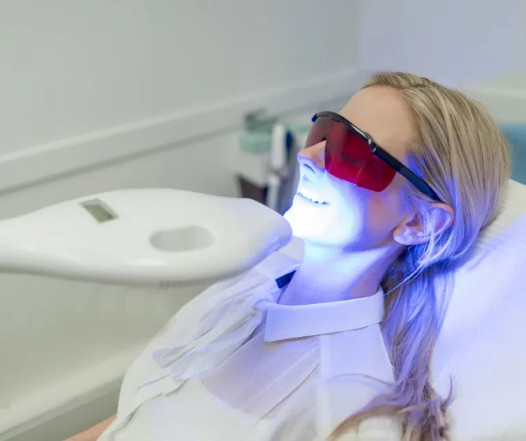 Laser teeth whitening treatment in Wethersfield CT