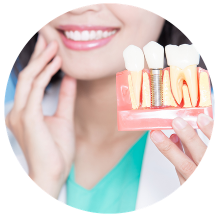 Dentist explaining dental Implant procedure in Wethersfield CT