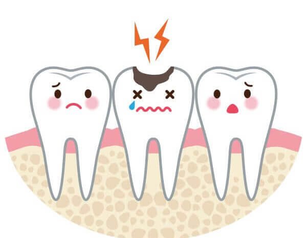 The 4 Most Common Signs of Tooth Decay